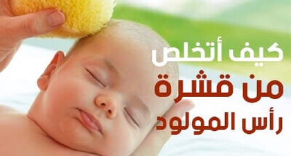 كيف أتخلص من قشرة رأس المولود