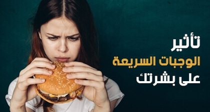 تأثير الوجبات السريعة على بشرتك