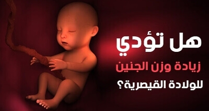 هل تؤدي زيادة وزن الجنين للولادة القيصرية؟