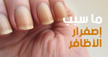 ما  سبب إصفرار الأظافر