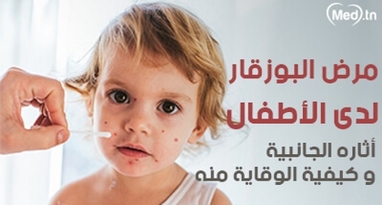 مرض البوزقار لدى الأطفال أثاره الجانبية و كيفية الوقاية منه