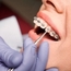 Dr Sofiene GHORBEL Ortodontist